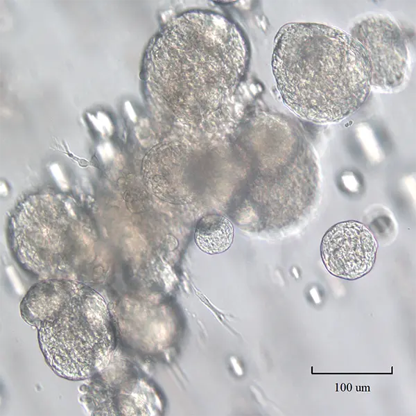 Human Mammary organoids with terminal end buds TEBs